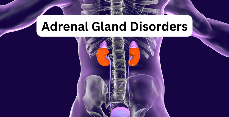 Adrenal Gland Disorders