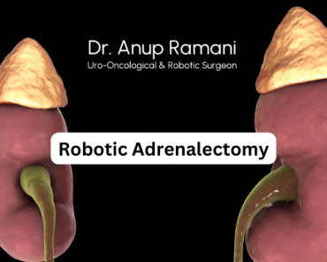 Preparing for Robotic Adrenalectomy: What Patients  ...