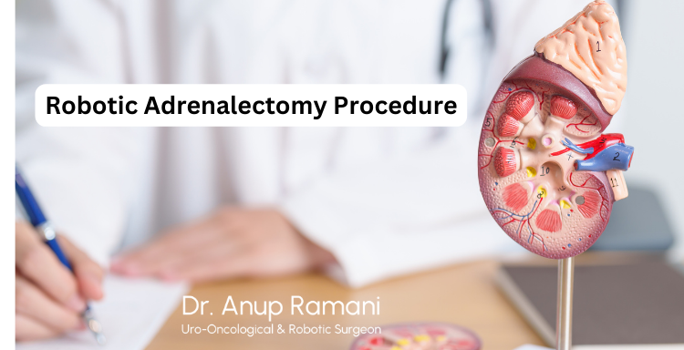 Robotic Adrenalectomy Procedure