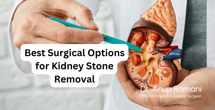 URS vs. RIRS: Understanding the Best Surgical Options for Kidney Stone Removal