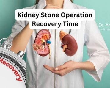 Kidney Stone Operation Recovery Time: What to Expec ...