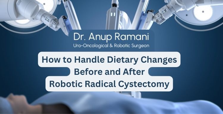 How to Handle Dietary Changes Before and After Robotic Radical Cystectomy