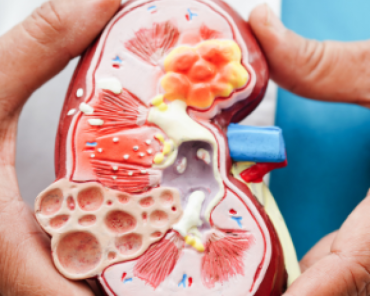 When Can Activities Be Safely Resumed After Kidney  ...