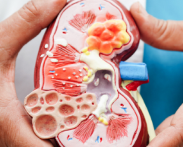 Why is a Catheter Kept After Kidney Stone Removal S ...
