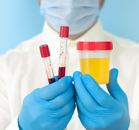 Urinary Bladder Cancer