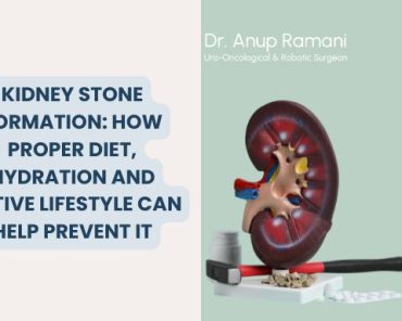 Kidney Stone Formation: How Proper Diet, Hydration  ...