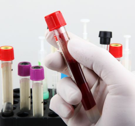 Reduced-Blood-Loss