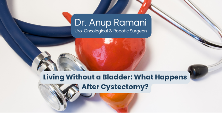 Living Without a Bladder: What Happens After Cystectomy?