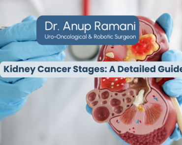 Kidney Cancer Stages: A Detailed Guide