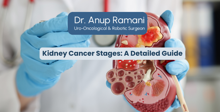Kidney Cancer Stages: A Detailed Guide