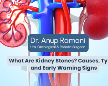 What Are Kidney Stones? Causes, Types, and Early Wa ...