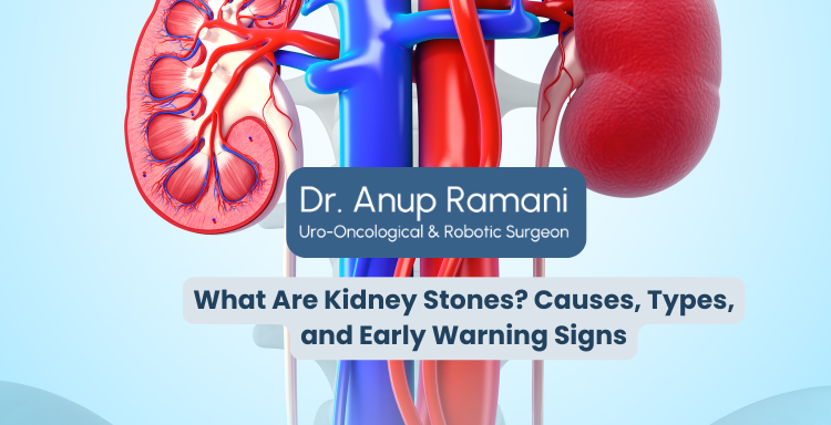 What Are Kidney Stones? Causes, Types, and Early Warning Signs