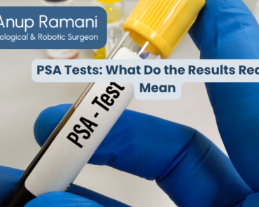 PSA Tests: What Do the Results Really Mean?