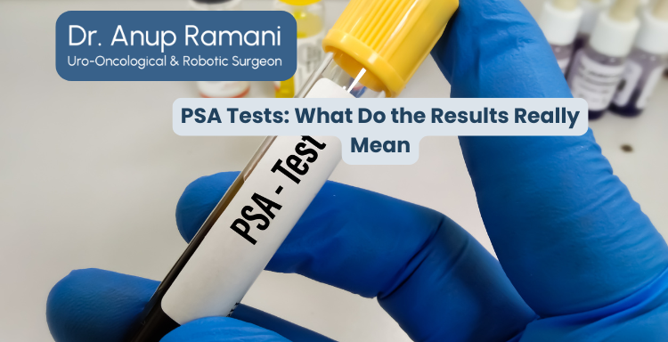 PSA Tests: What Do the Results Really Mean?