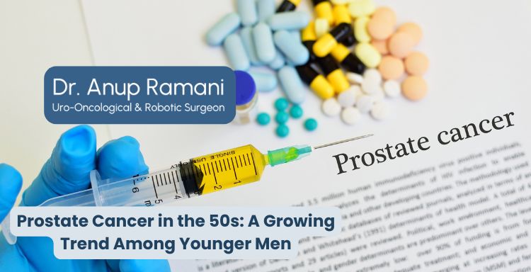 Prostate Cancer in the 50s: A Growing Trend Among Younger Men