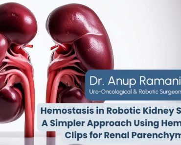 Hemostasis in Robotic Kidney Surgery: A Simpler App ...
