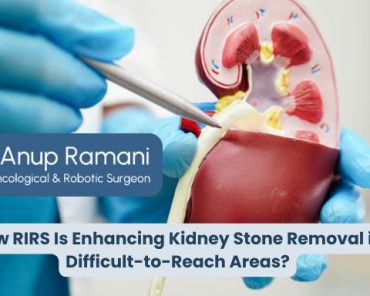 How RIRS Is Enhancing Kidney Stone Removal in Diffi ...