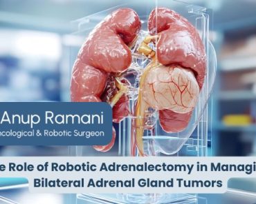 The Role of Robotic Adrenalectomy in Managing Bilat ...