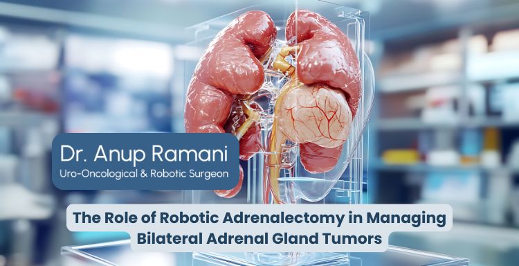 The Role of Robotic Adrenalectomy in Managing Bilateral Adrenal Gland Tumors