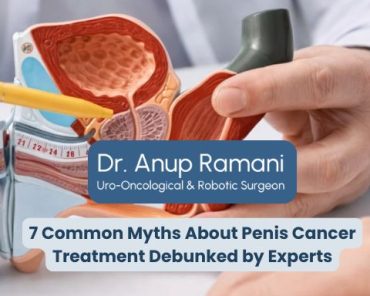 7 Common Myths About Penis Cancer Treatment Debunke ...