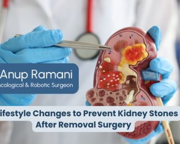 5 Lifestyle Changes to Prevent Kidney Stones After  ...