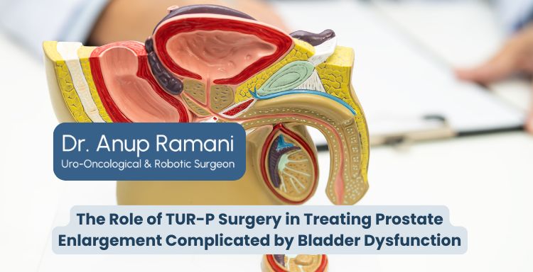 The Role of TUR-P Surgery in Treating Prostate Enlargement Complicated by Bladder Dysfunction
