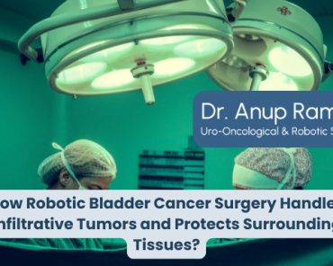 How Robotic Bladder Cancer Surgery Handles Infiltra ...
