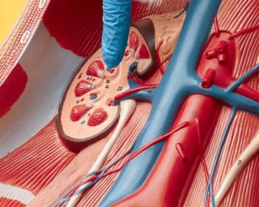 How Does Laser Remove Kidney Stones Without Cuts