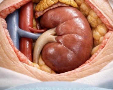 How is Robotic Adrenalectomy Performed Using the Da ...