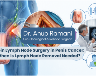 Groin Lymph Node Surgery in Penis Cancer: When Is L ...