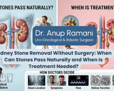 Kidney Stone Removal Without Surgery: When Can Ston ...