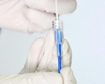 What Should a Patient Follow After Prostate Cancer  ...