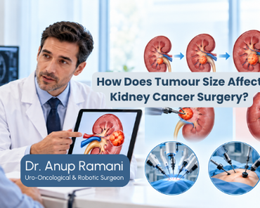 How Does Tumour Size Affect Kidney Cancer Surgery?