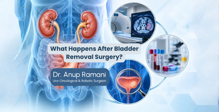 What Happens After Bladder Removal Surgery?