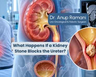 What Happens If a Kidney Stone Blocks the Ureter?