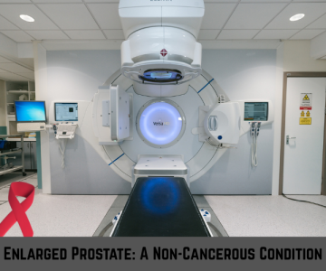 Enlarged-Prostate