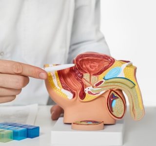 prostate cancer surgeons