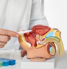 prostate cancer surgeons